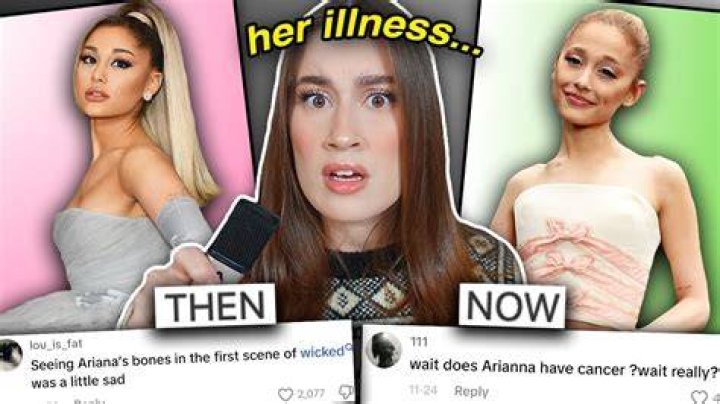 Ariana Grande and the Leukemia Connection: A Story of Strength and Resilience