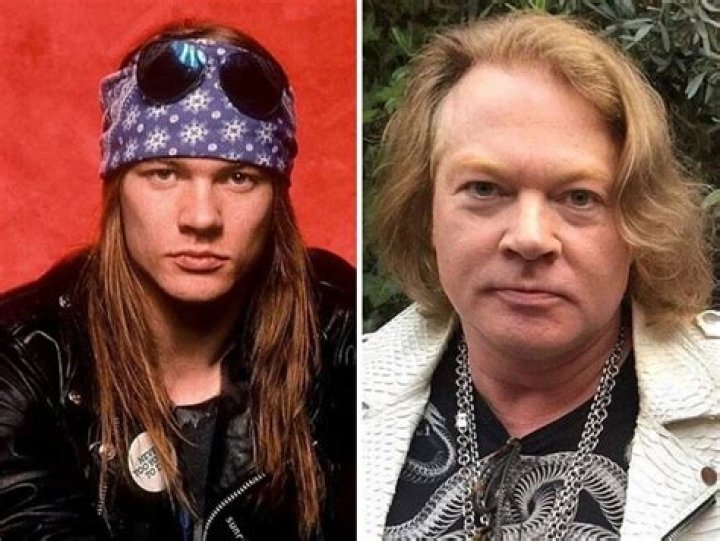 Axl Rose Now: The Evolution of Rock's Iconic Frontman