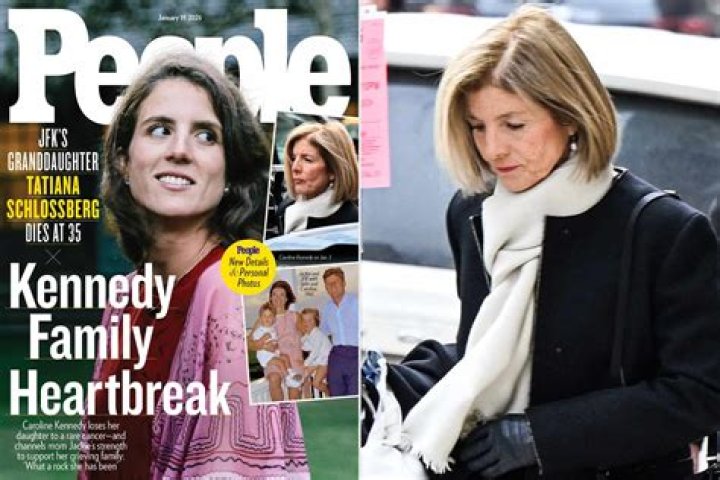 Caroline Kennedy Wrinkles Cause: The Real Story Behind the Headlines
