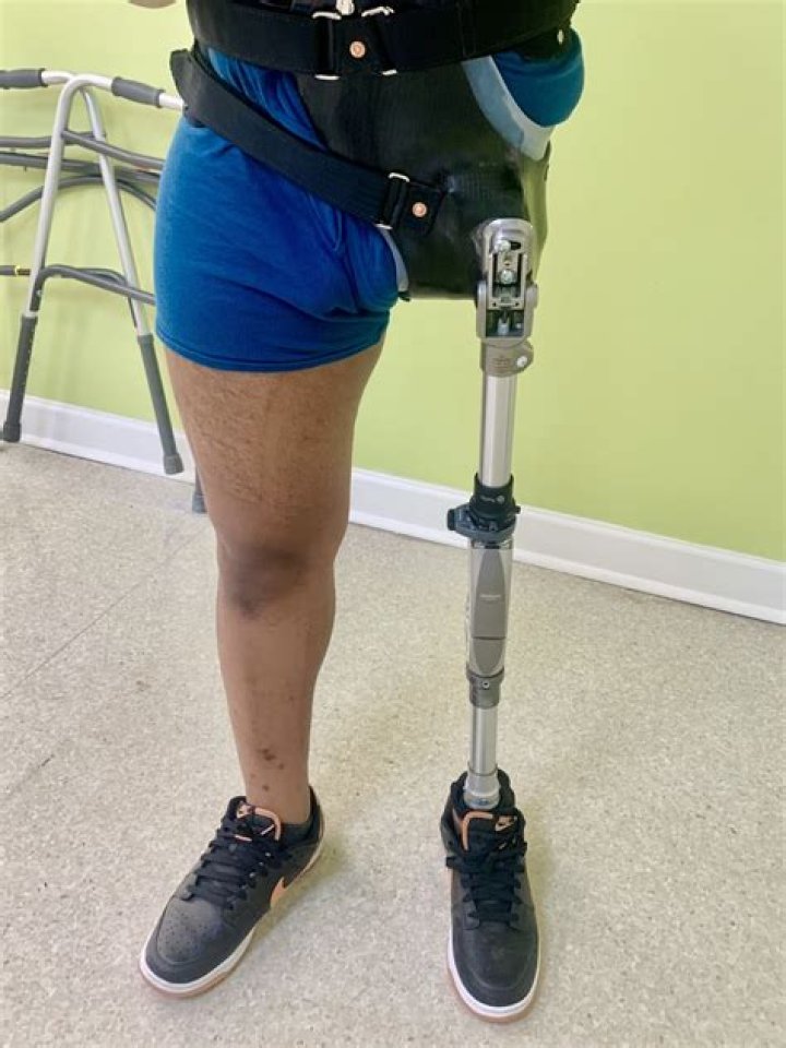 LaVar Ball Opens Up About Leg Amputation Due to Diabetes: A Journey Through Pain and Resilience