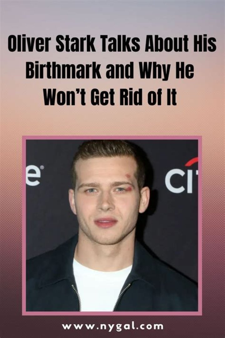 Oliver Stark Birthmark: The Hidden Story Behind the Mark