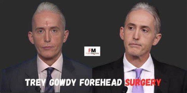 Trey Gowdy Nose Surgery: The Untold Story You Need to Know